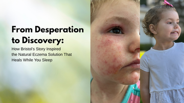 From Desperation to Discovery: How Bristol’s Story Inspired a Natural Eczema Solution That Heals While You Sleep