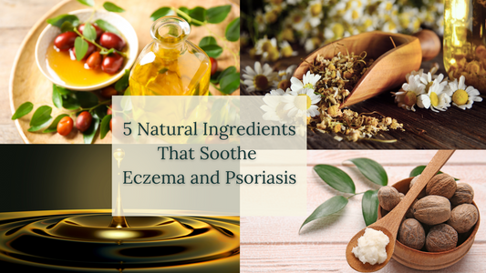 5 Natural Ingredients That Soothe Eczema and Psoriasis