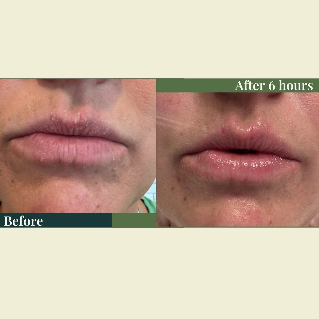 Bristol Butter Lip Balm – Silky, Hydrated, and Healed Lips